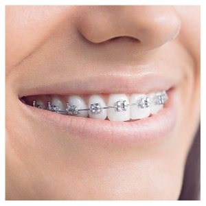 Oral-B Interspace Aufsteckbürsten 2er 