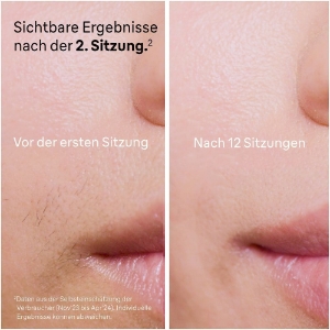 Braun Personal Care PL5052 IPL Silk·expert Pro 5, Haarentfernung für zuhause, mit Aufbewahrungstasche