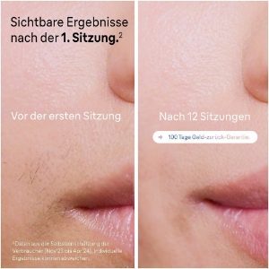 Braun Personal Care PL7147 Smart IPL Skin i·expert Haarentfernung für zu Hause, Gratis App, Aufbewahrungstasche