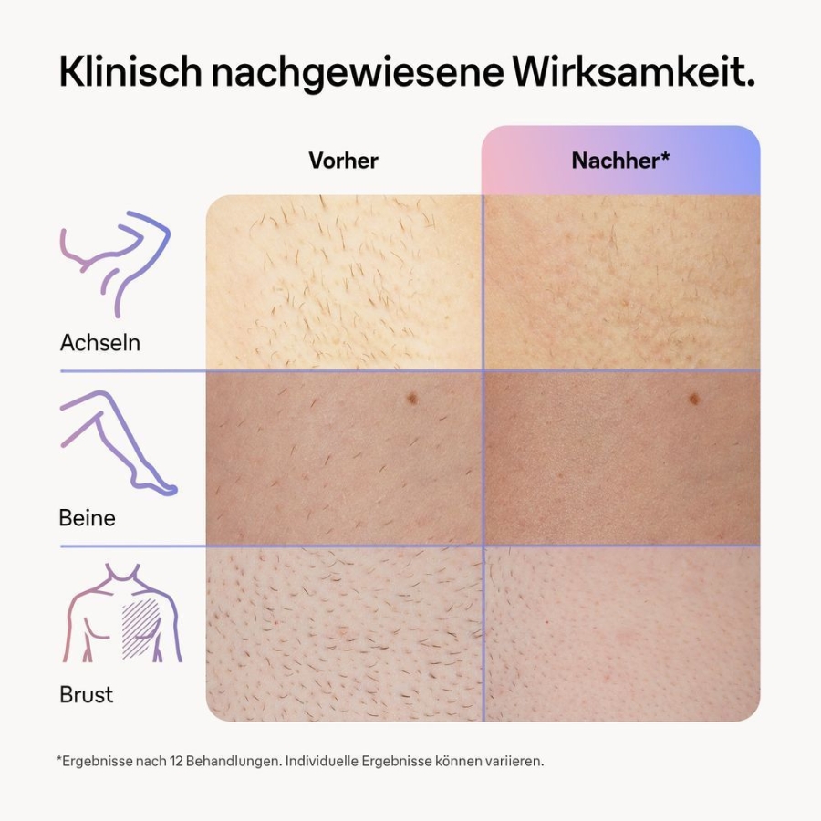 Braun Personal Care Smart IPL PL725 Skin i·expert, Haarentfernung für zu Hause, Gratis App, Aufbewahrungstasche, Venus Rasierer, 3 Aufsätze
